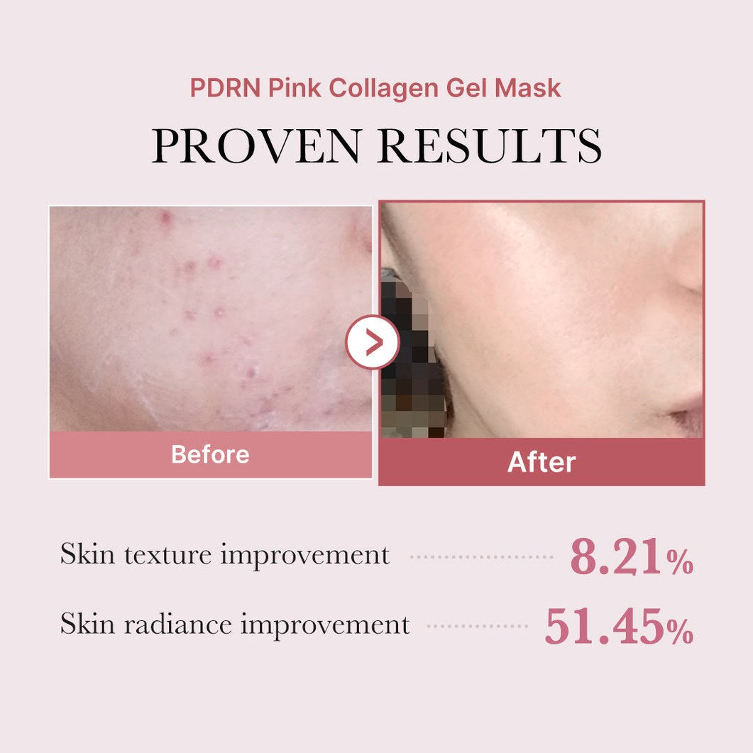 Glass Glow 3-Step Set — Zero Pore Pad + PDRN Serum + Collagen Gel Mask