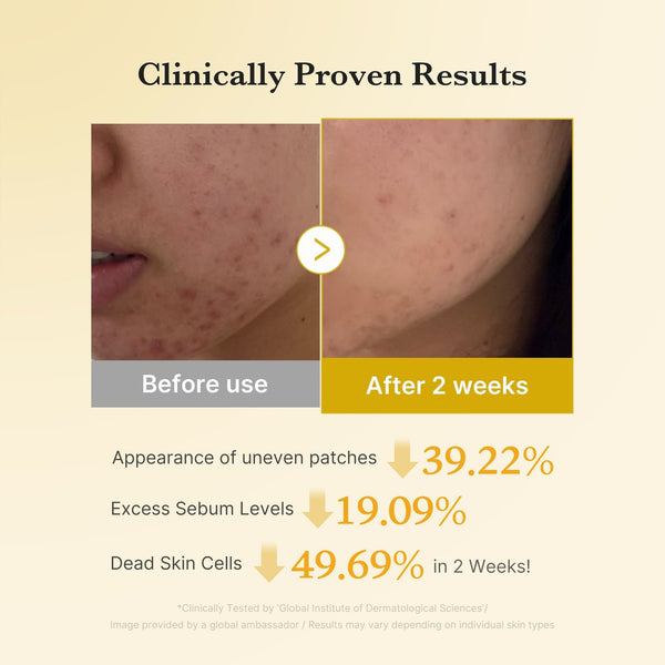 Daily Gentle Exfoliation