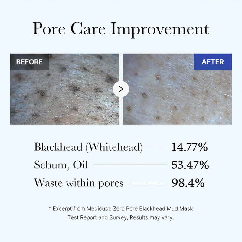 Deep Pore Cleansing for Visibly Blackhead-Free Skin