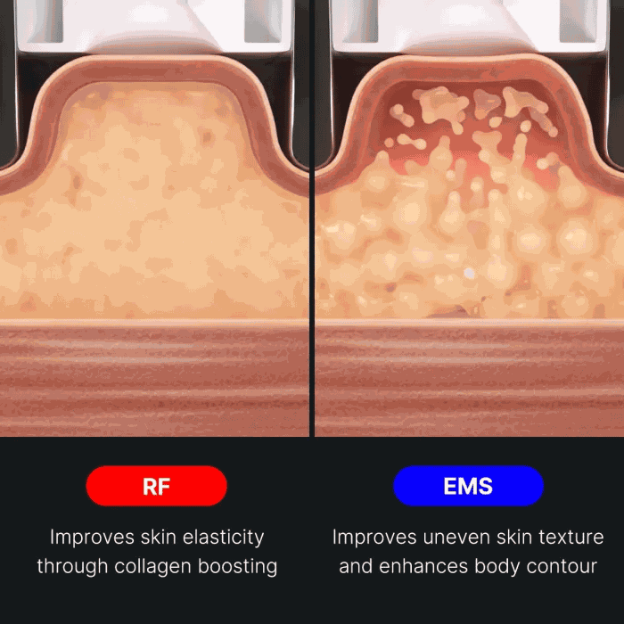 AGE-R Contour Body Shot