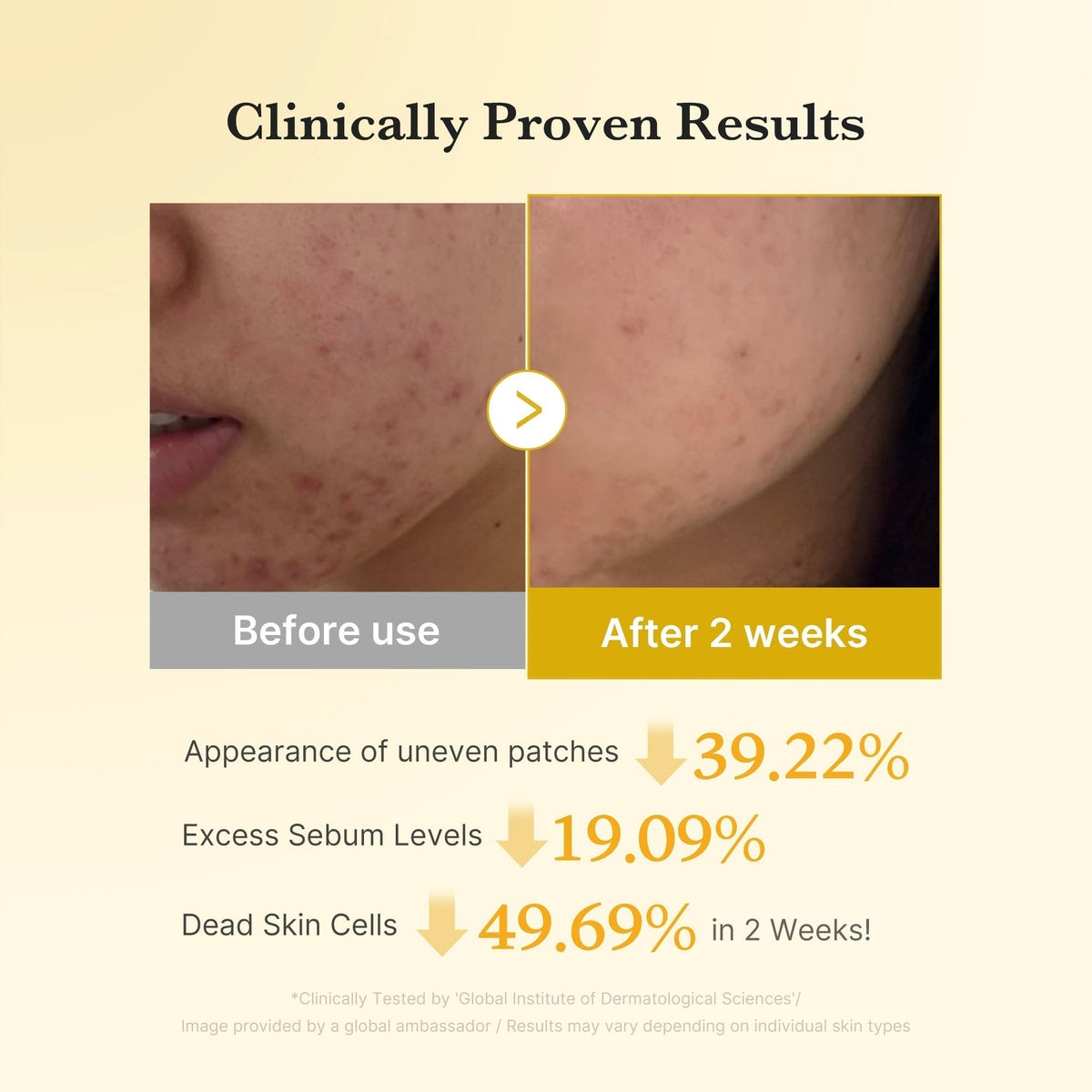 Kojic Turmeric Brightening Set