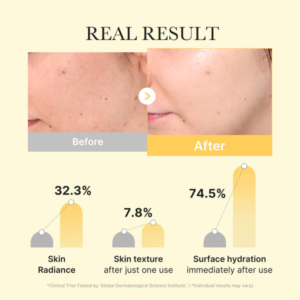 24K Gold Anti-Aging